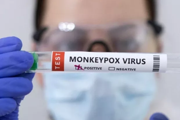 У Московській області в місцевих виявили рідкісну хворобу (фото)