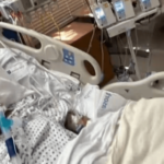 Купила на місцевому ринку: Жінка втратила всі кінцівки після вживання недосмаженої риби