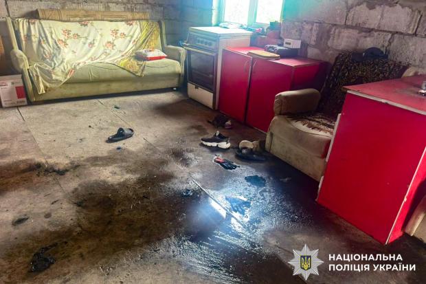 На Рівненщині госпіталізували з термічними опіками чоловіка та жінку, бо та курила сигарету, заливаючи бензин у газонокосарку